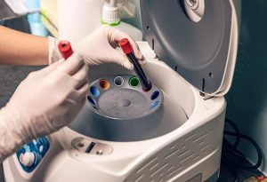 medical test for gluten sensitivity