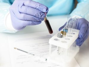 blood test for gut inflammation