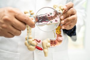 doctor holding model of the digestive system