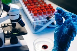 blood test for fasting blood glucose