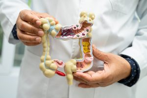 doctor with a model of the gut
