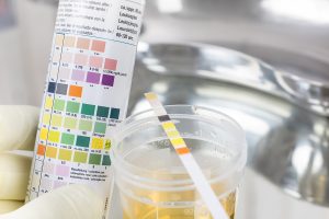 PH test in medical laboratory