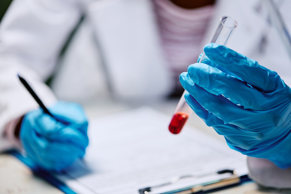 the best tests for Fusobacterium nucleatum